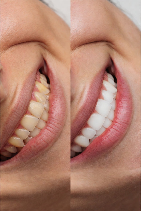 Purple Smile Brightening Paste